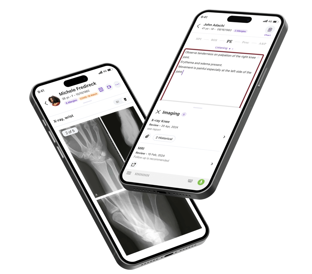 Two iphones displaying orthopedic images and electronic health records